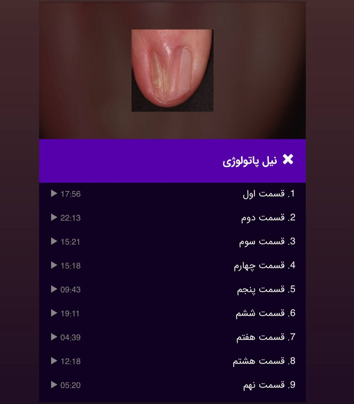 دوره نیل پاتولوژی(بیماری های ناخن)